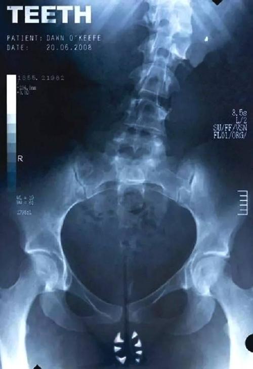 诺里奇艺术与设计学院Physicsdegree